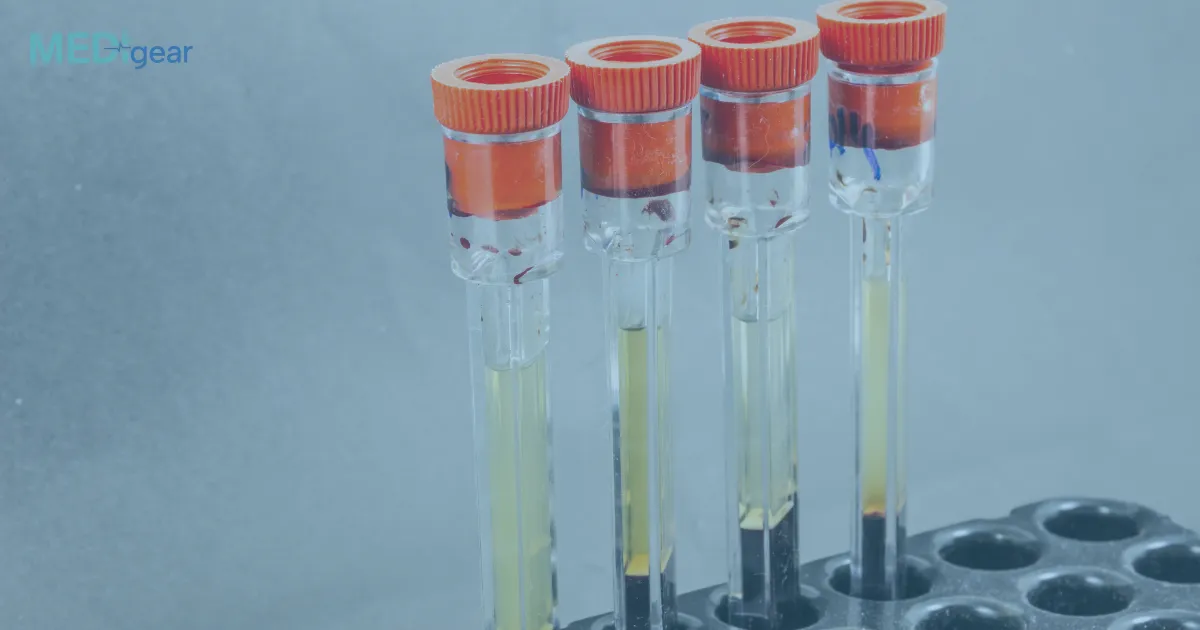 What Is the Role of ESR Analyzers in Inflammation Testing?