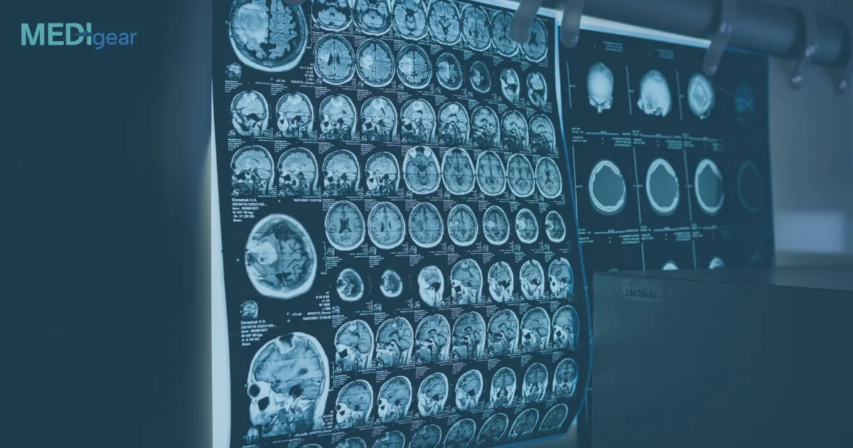 What’s the future of whole-body MRI in oncology screening?