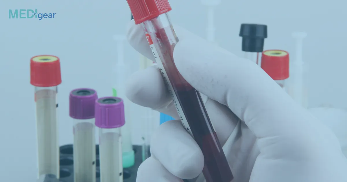 How do blood culture systems detect sepsis early?