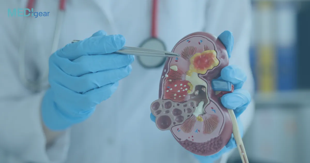 What are the best modern treatments for chronic kidney disease?