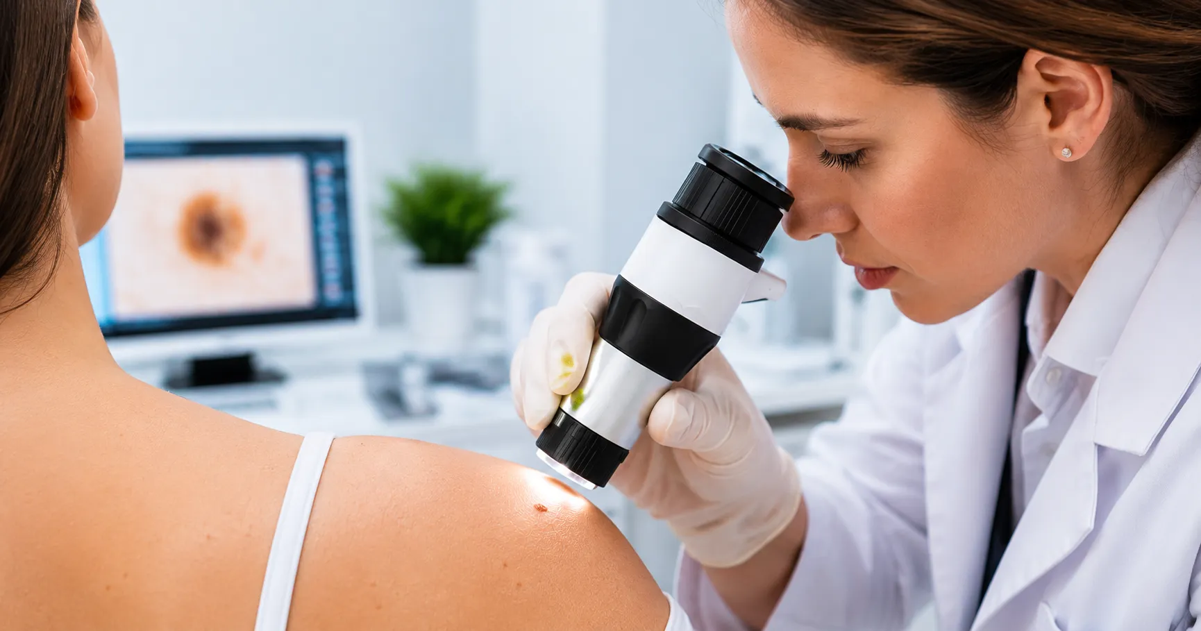  Clinical illustration of a handheld dermatoscope applied to a skin lesion showing the magnified der