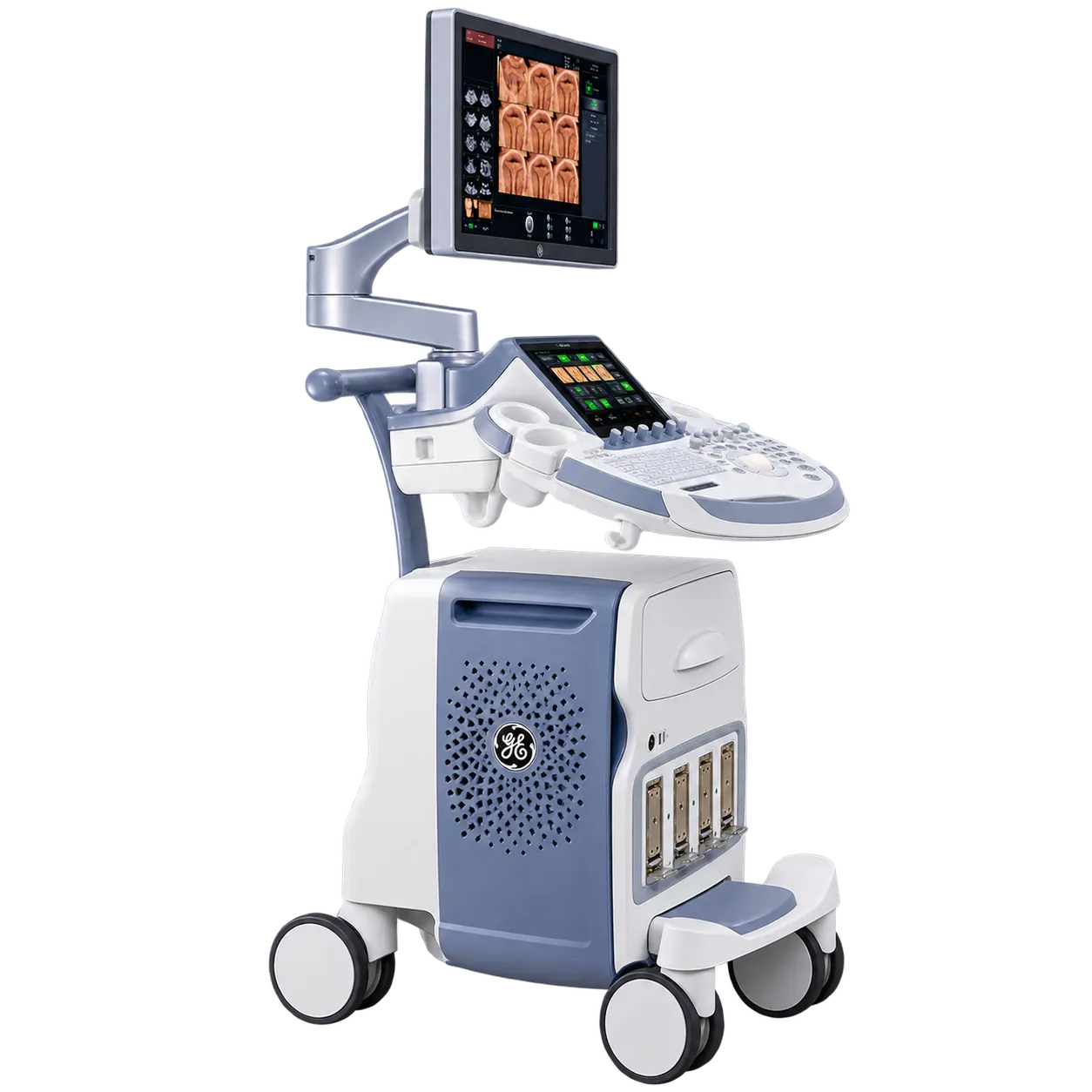 GE HealthCare Voluson E6 (2015)