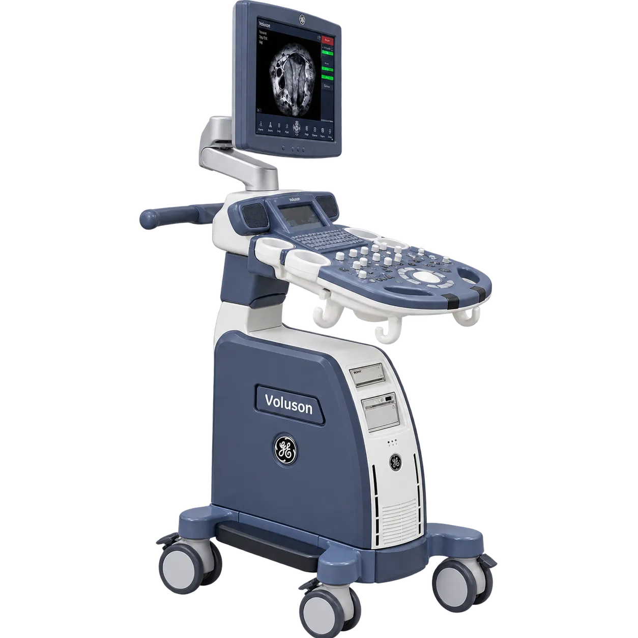 GE HealthCare Voluson P6 (2017)