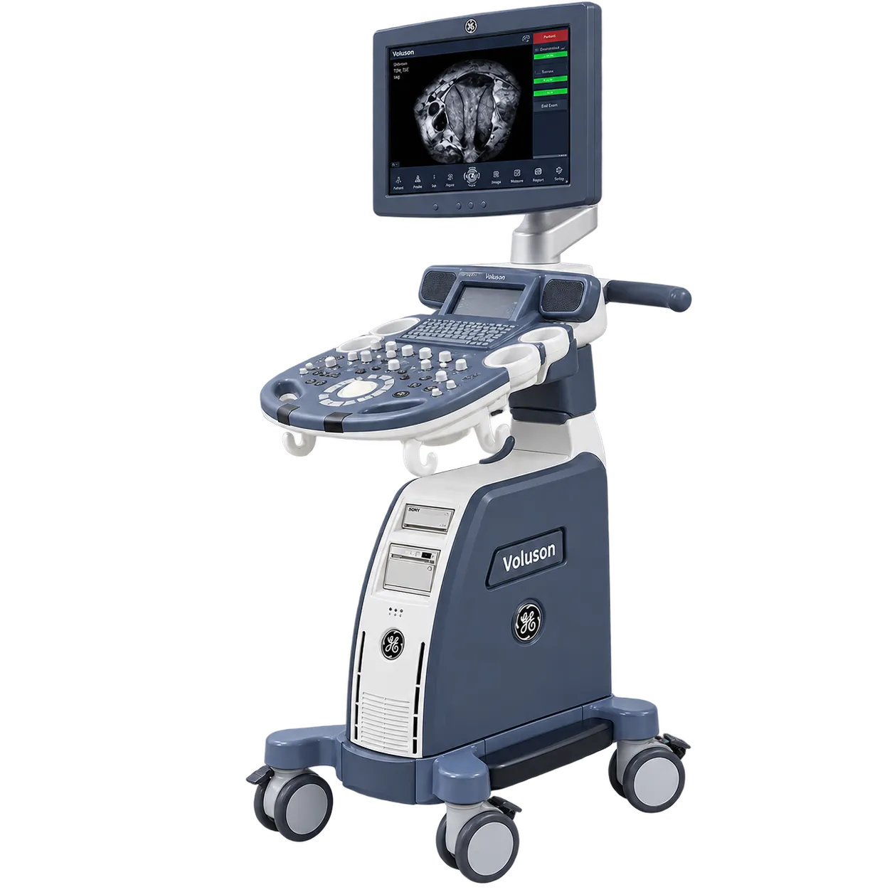 GE HealthCare Voluson P6 (2017)