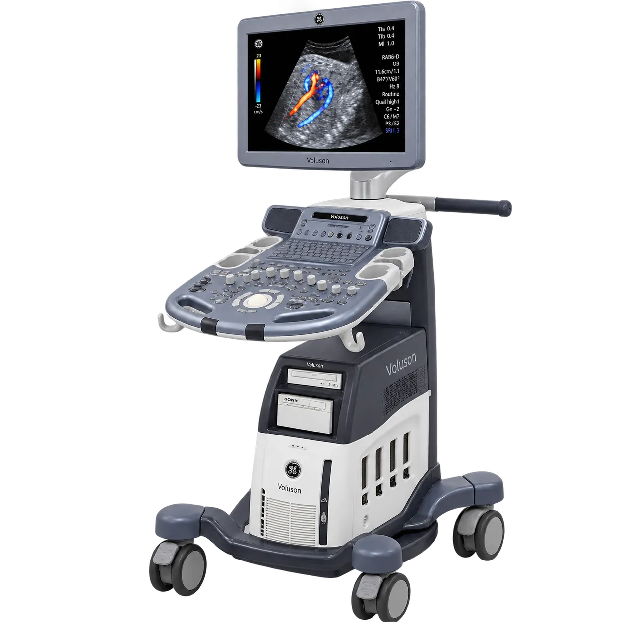 GE HealthCare Voluson S6 (2014)