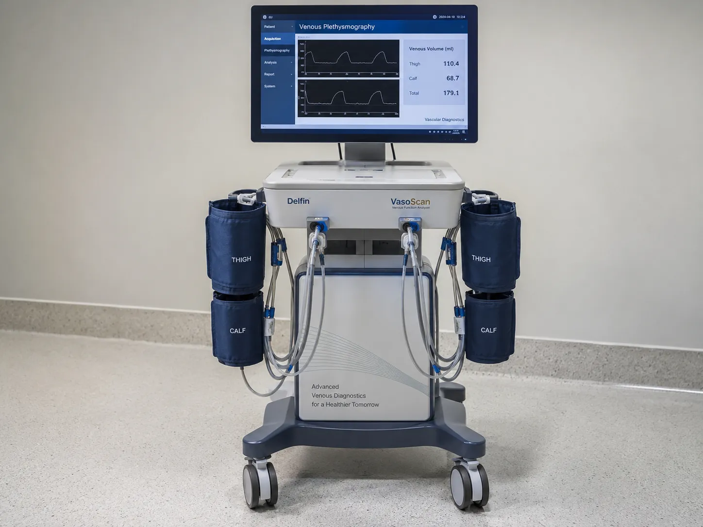 Air plethysmography cuff on a patient's calf measuring venous volume change during standing and toe-